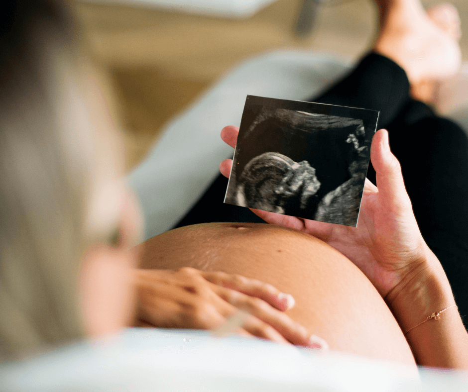 Omega 3 for pregnancy